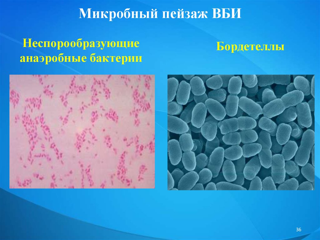 Презентация по микробиологии вби