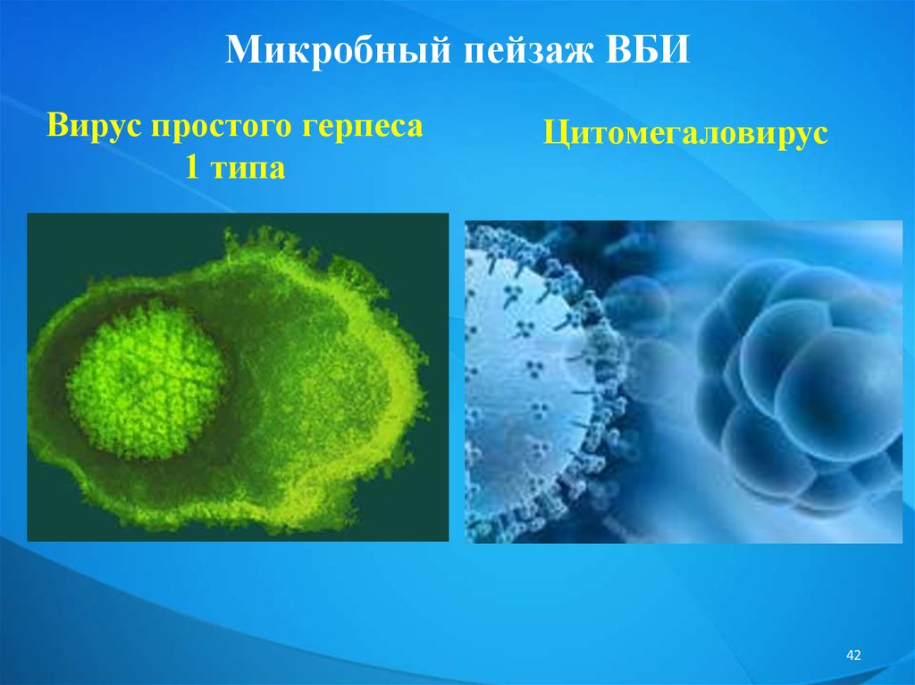 Вирус герпеса 2 типа. Вирус простого герпеса 1 типа. Микробный пейзаж внутрибольничных инфекций. Вирус герпеса микробиология.