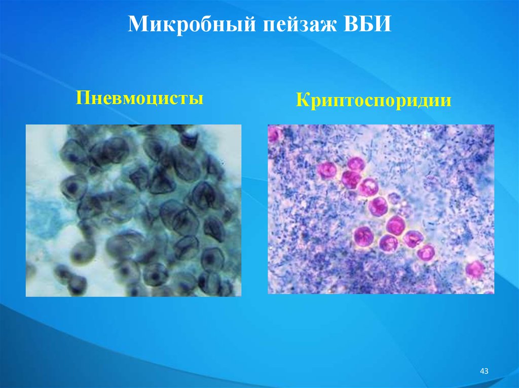 Внутрибольничная инфекция микробиология презентация