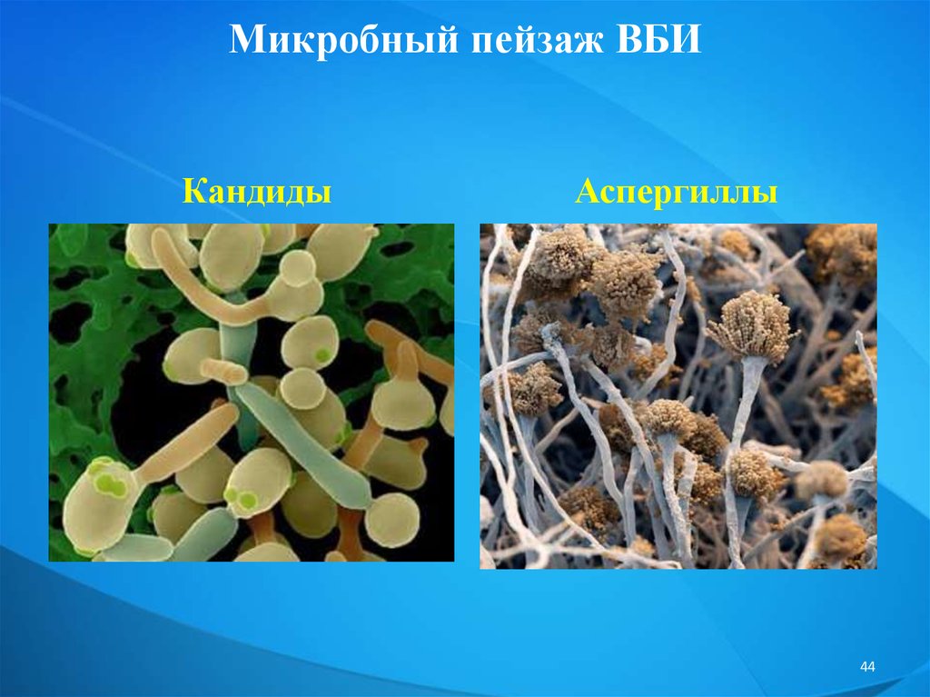 Презентация по микробиологии вби