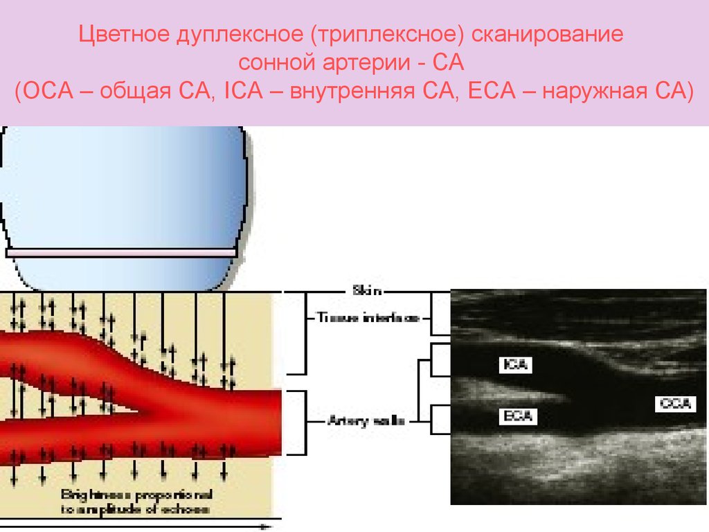 Дуплексное сканирование сосудов что это. Дуплексное и триплексное сканирование. Дуплексное сканирование сосудов. Ультразвуковое триплексное сканирование. Дуплексное (триплексное) сканирование артерий.
