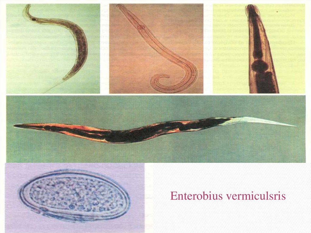К какому типу животных относят аскариду. Аскариды, острицы, трихинеллы. Круглые гельминты,нематоды.