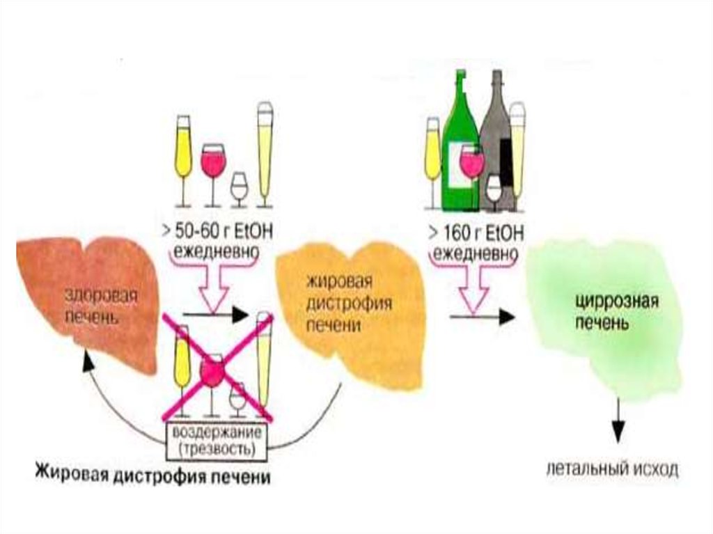 Жировая инфильтрация печени биохимия схема