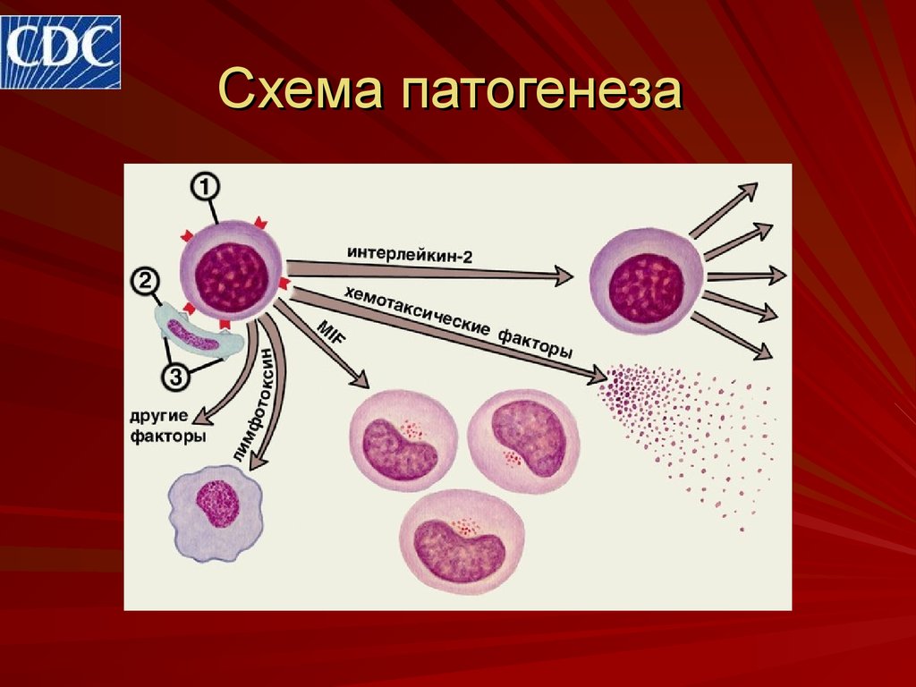 Патогенез лейкозов схема