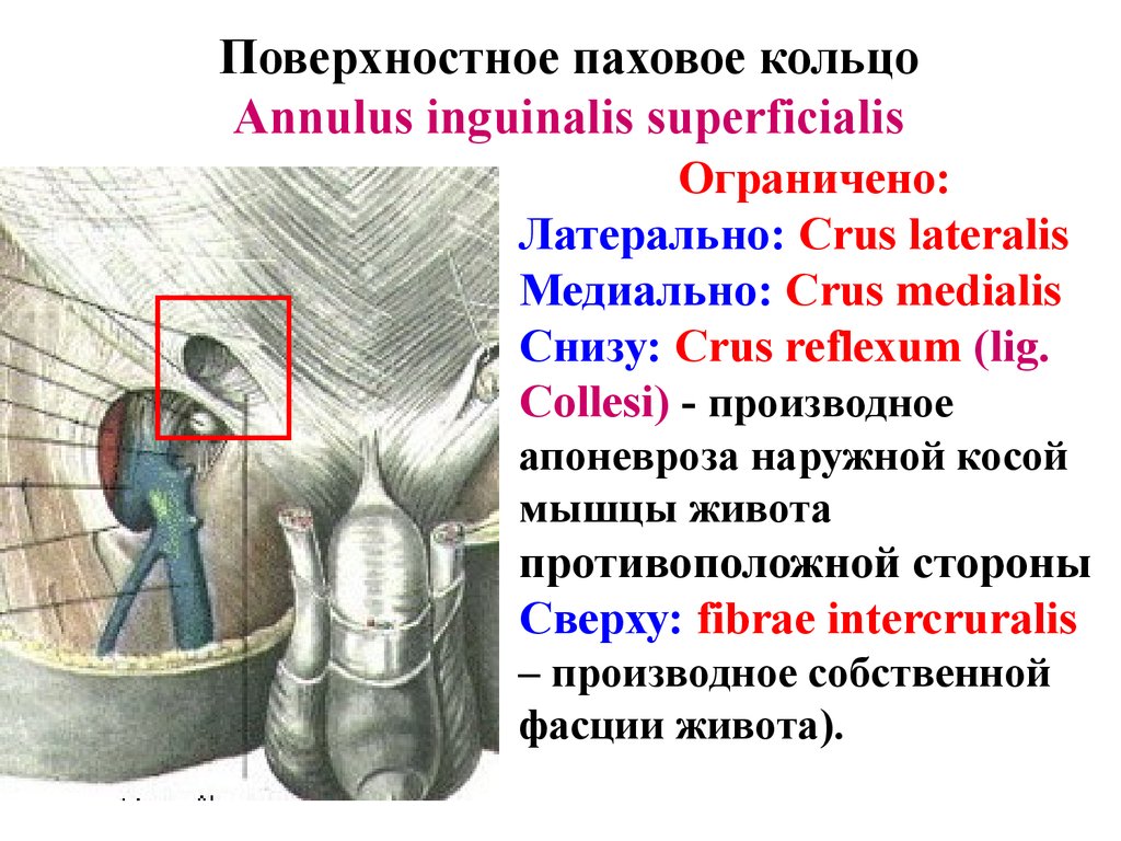 Поверхностное паховое кольцо. Стенки пахового канала топографическая анатомия. Поверхностное паховое кольцо стенки. Поверхностное паховое кольцо топография. Поверхностное и глубокое кольцо пахового канала.