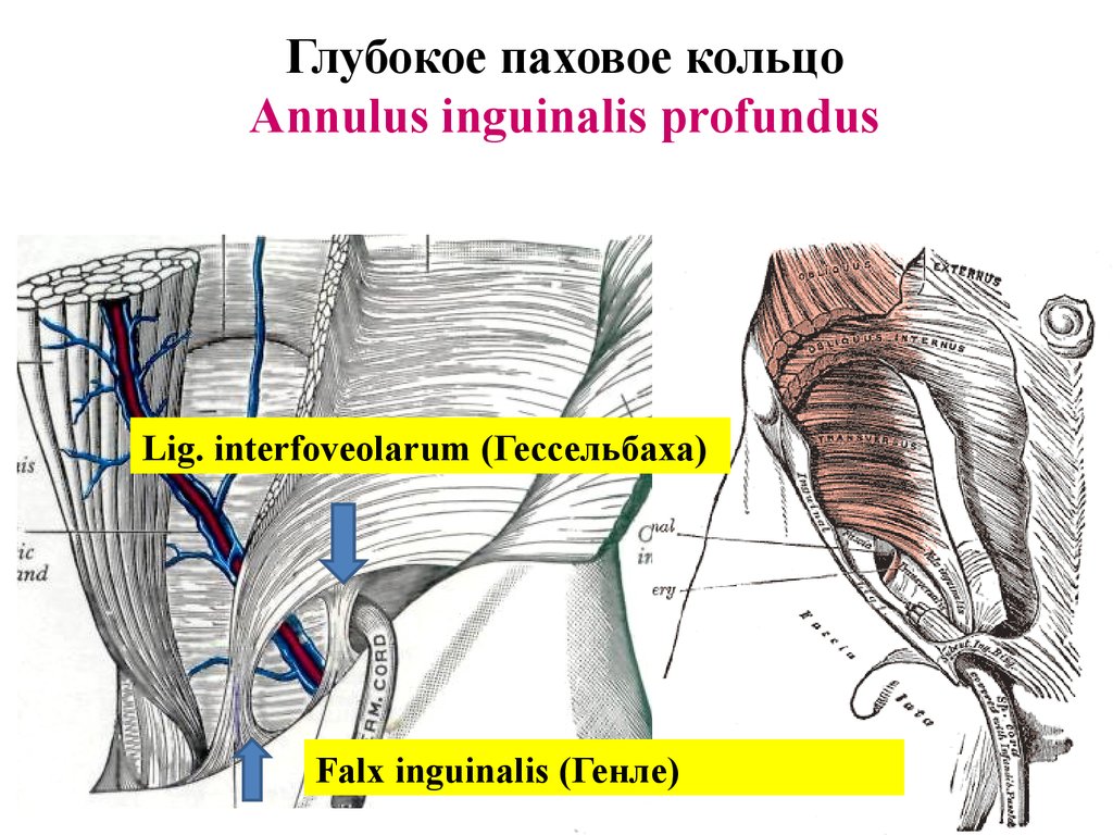 Паховые кольца у футболистов. Глубокое паховое кольцо анатомия. Falx inguinalis. Внутреннее паховое кольцо анатомия. Поверхностное паховое кольцо (anulus inguinalis superficialis) образовано:.