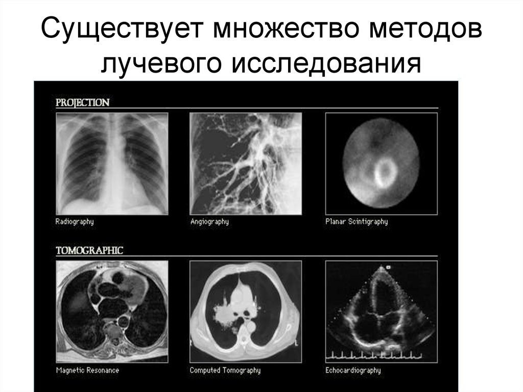 Лучевые методы. Лучевая диагностика легких методы. Курсовая по лучевой диагностике. Лучевая диагностика заболеваний сердца и сосудов виды. Патологии сердца схема лучевая диагностика.