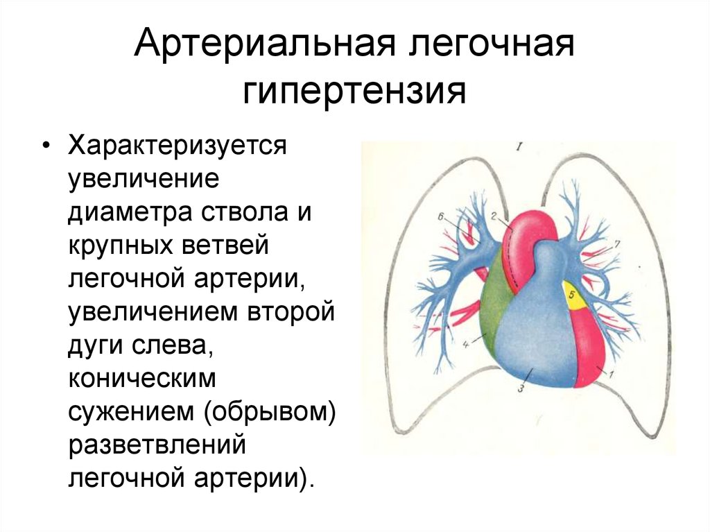 Легочная гипертензия что это. Клинические проявления легочной гипертензии. Легочная (артериальная) гипертензия (идиопатическая) (первичная). Легочная артериальная гипотензия. Гипертензия легочной артерии.