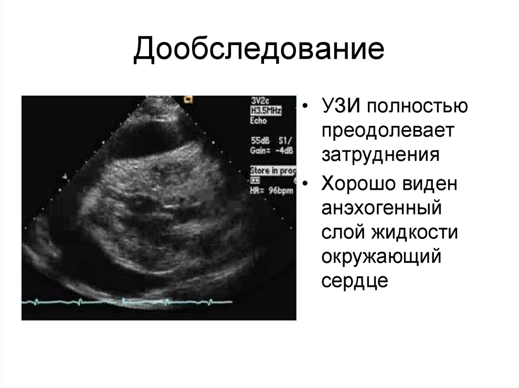 Узи полное. Анэхогенная жидкость ДЦК 36мм. Анэхогенная структура что это. Анэхогенная структура УЗИ. Жидкость на УЗИ анэхогенное.