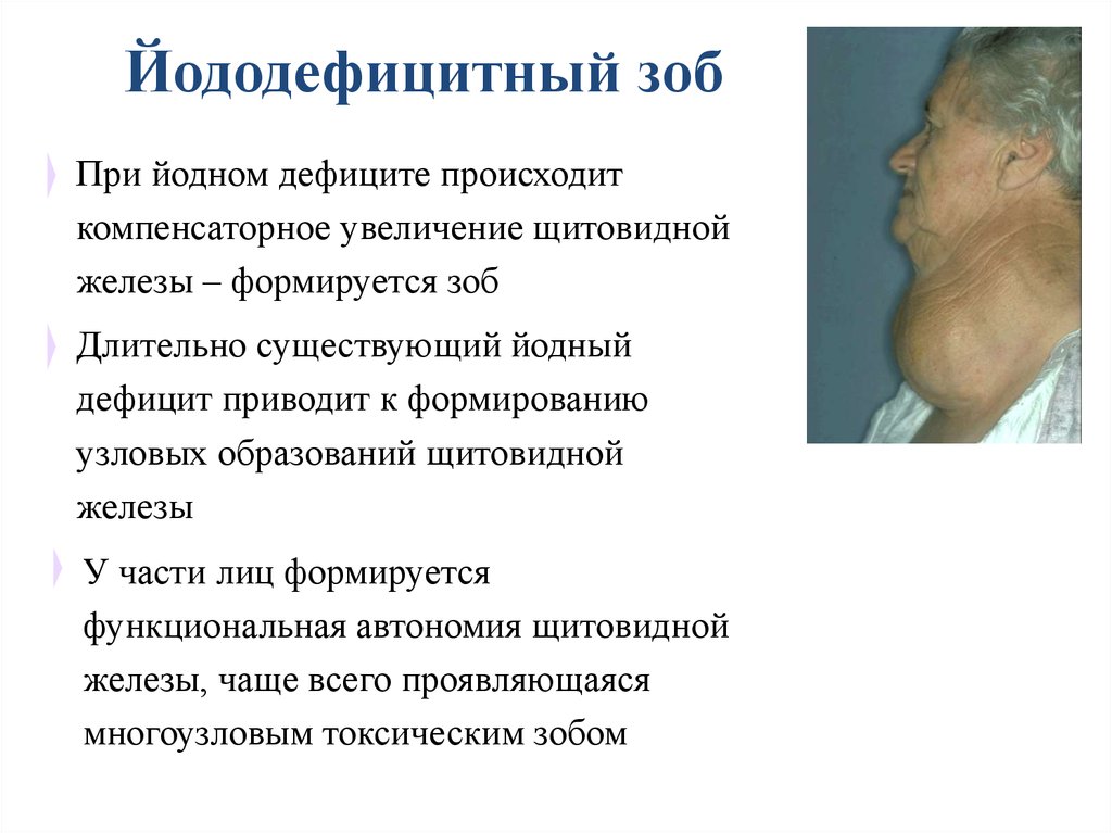 Щитовидная железа недостаток гормонов. Функциональная автономия щитовидной железы. Щитовидная железа заболевания при недостатке и избытке гормонов. Недостаток гормонов щитовидной желез.