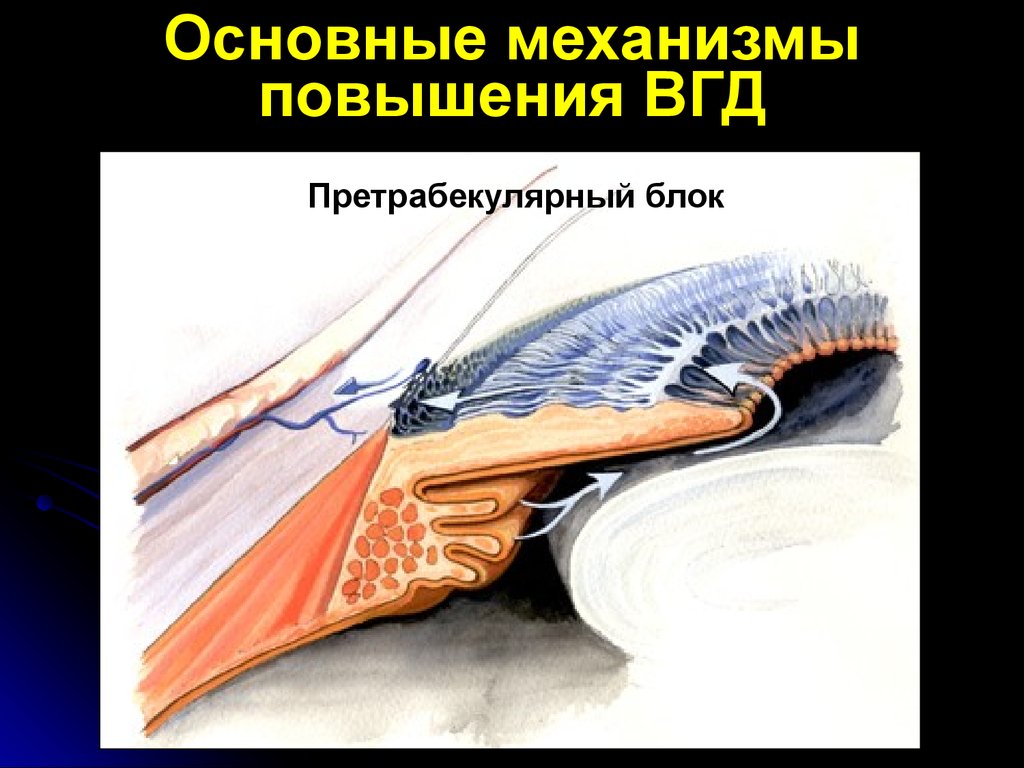 Гидродинамика глаза. Нарушение гидродинамики глаза. Нарушение гемо и гидродинамики глаза. Трабекулярный аппарат глаза.