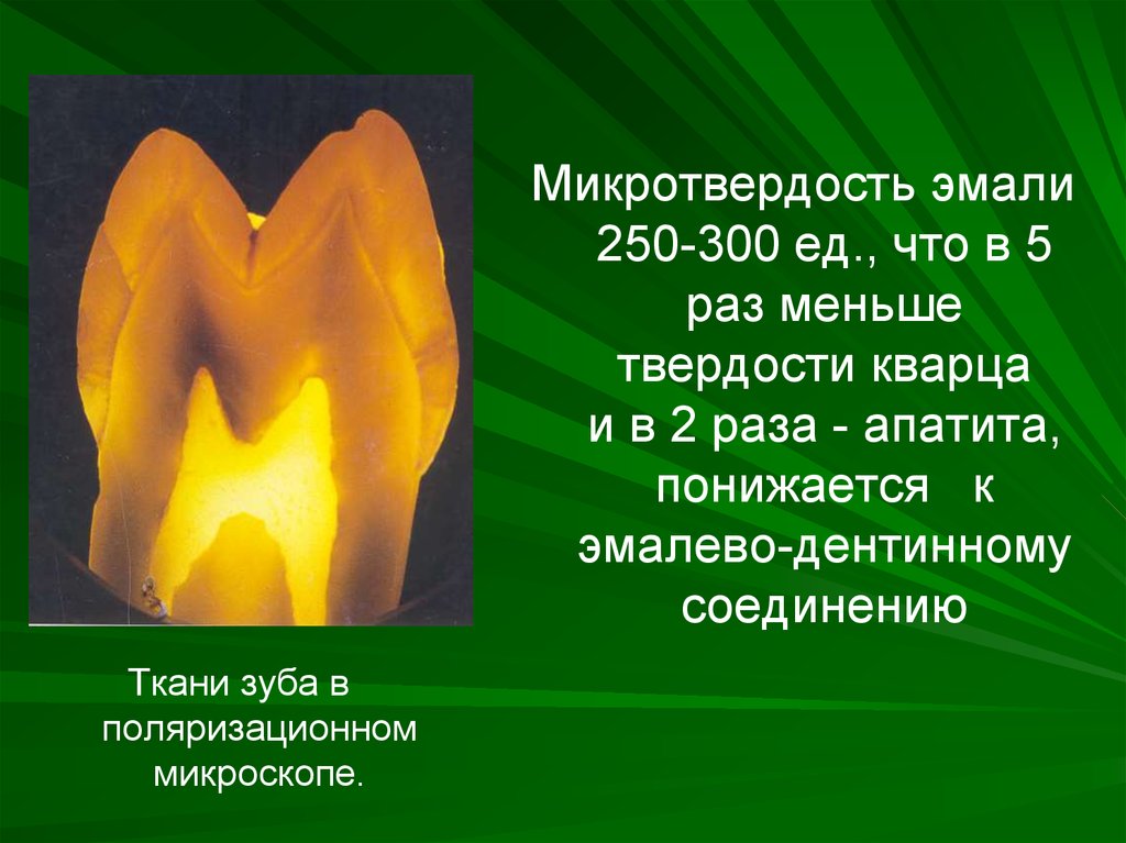 Микротвердость. Ткани зуба в поляризационном микроскопе. Микротвердость дентина зуба. Микротвердость тканей зуба это.