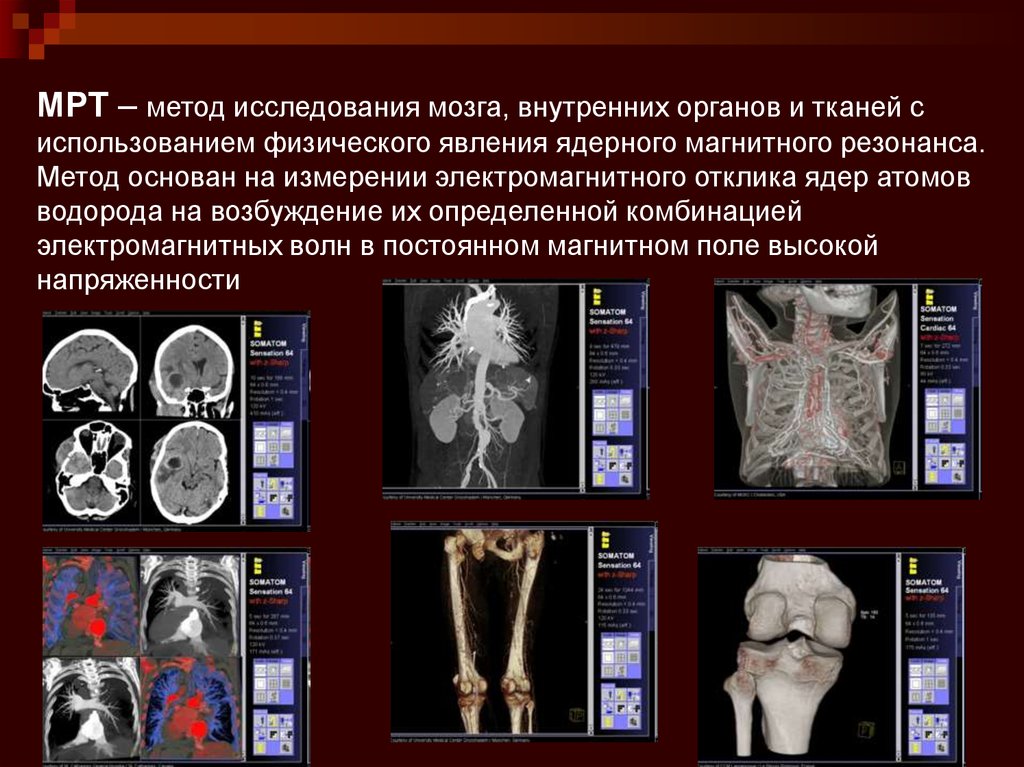 Метод магнитной томографии