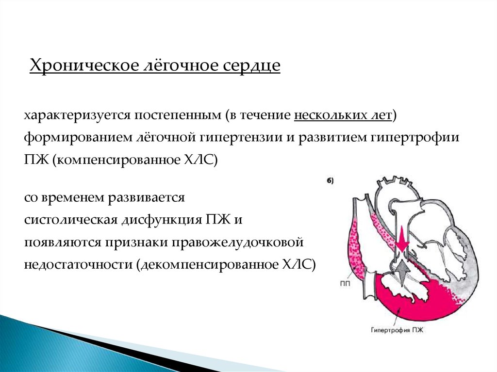 Легочное сердце картинки