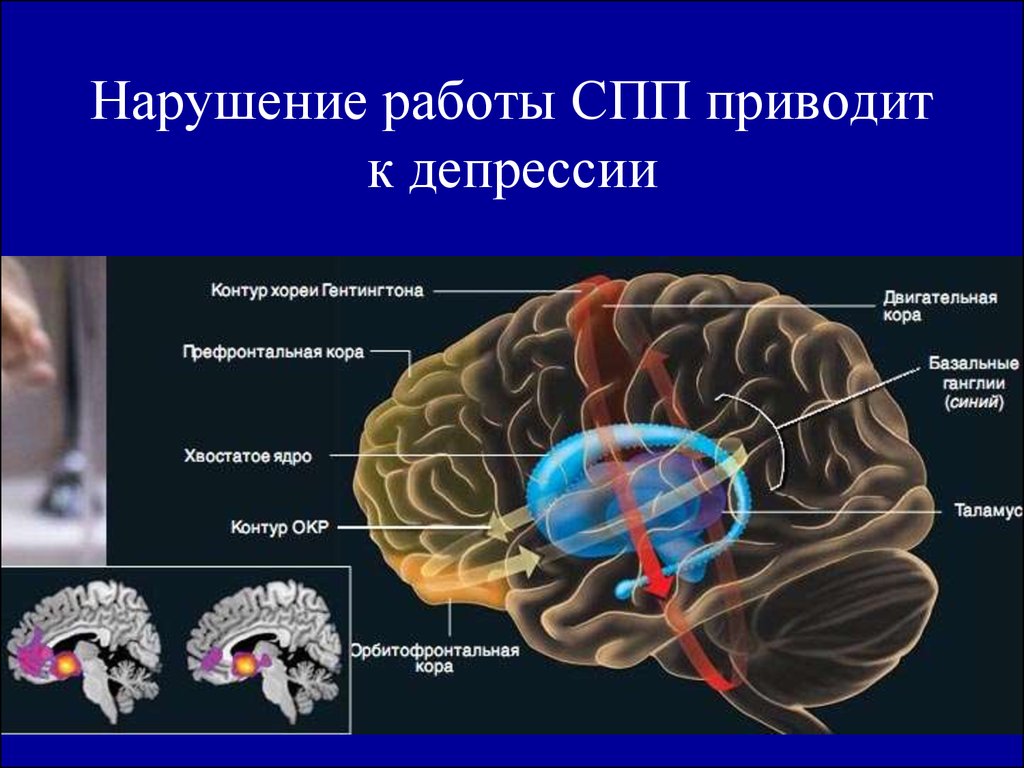 Нарушения работы мозга. Орбитофронтальная кора головного мозга. Окр мозг. Мозг человека с депрессией.