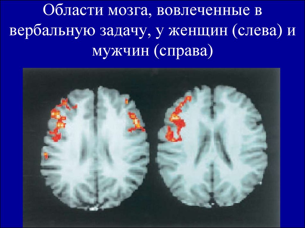 Области мозга, вовлеченные в вербальную задачу, у женщин (слева) и мужчин (справа)
