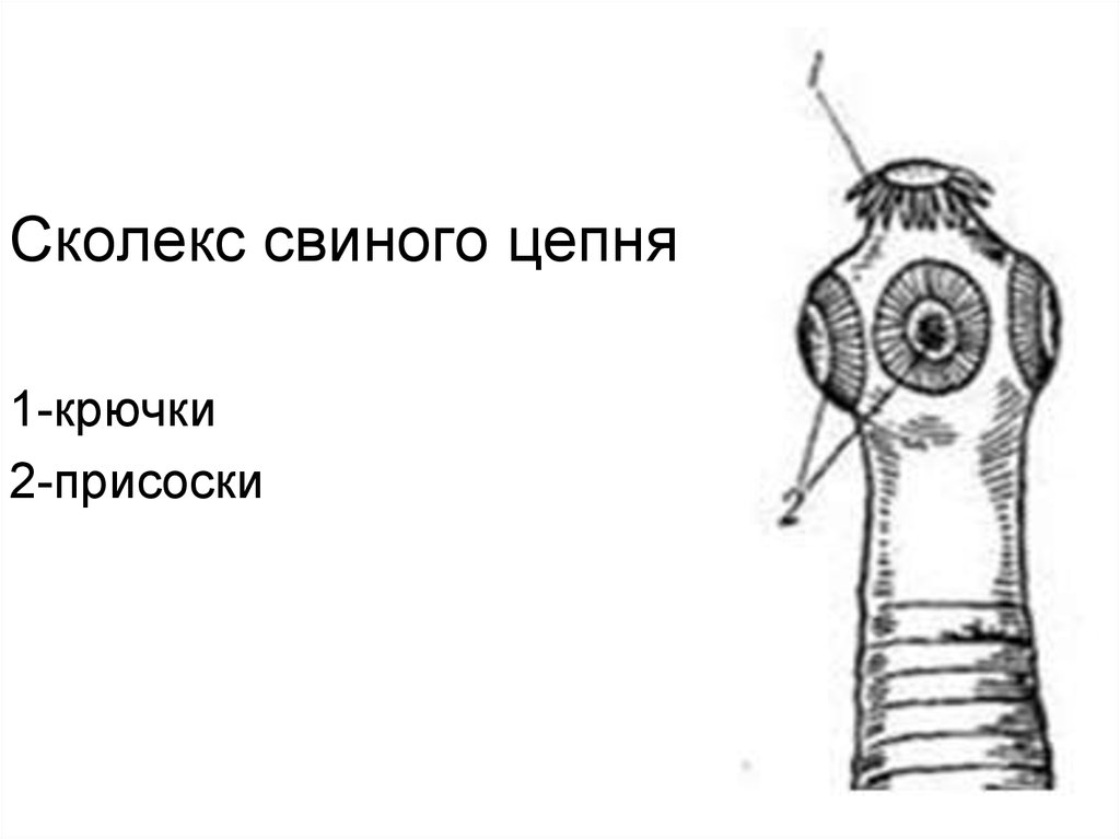 Сколекс бычьего цепней. Строение сколекса свиного цепня. Сколексы свиного и бычьего цепня. Строение сколекса бычьего цепня. Сколекс свиного вооруженного цепня.