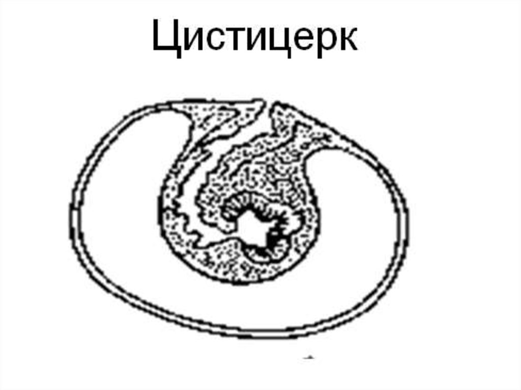 Финна бычьего цепня рисунок