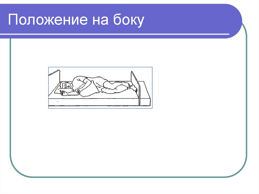 Ч положение. Положение пациента на боку. Положение лежа на больном боку. Положение пациента лежа на боку. Положение на боку больного.