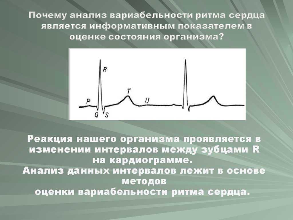 Вариабельность сердечного ритма. Вариабельность ритма сердца исследование. Анализ вариабельности ритма сердца. Вариабельность сердечного ритма на ЭКГ. Оценка ритма сердца.