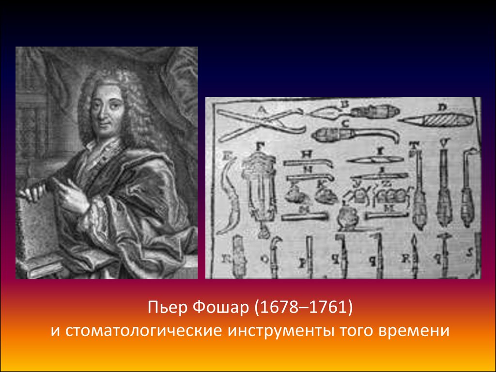 Пьер Фошар (1678–1761) и стоматологические инструменты того времени