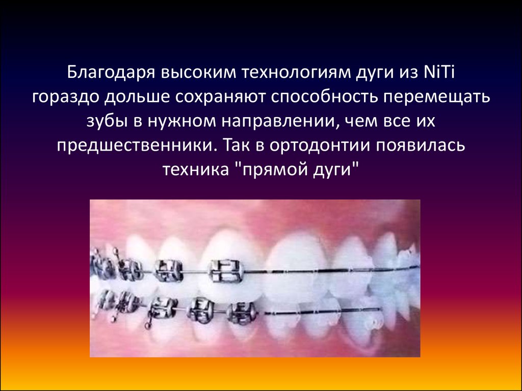 Презентация брекеты ортодонтия