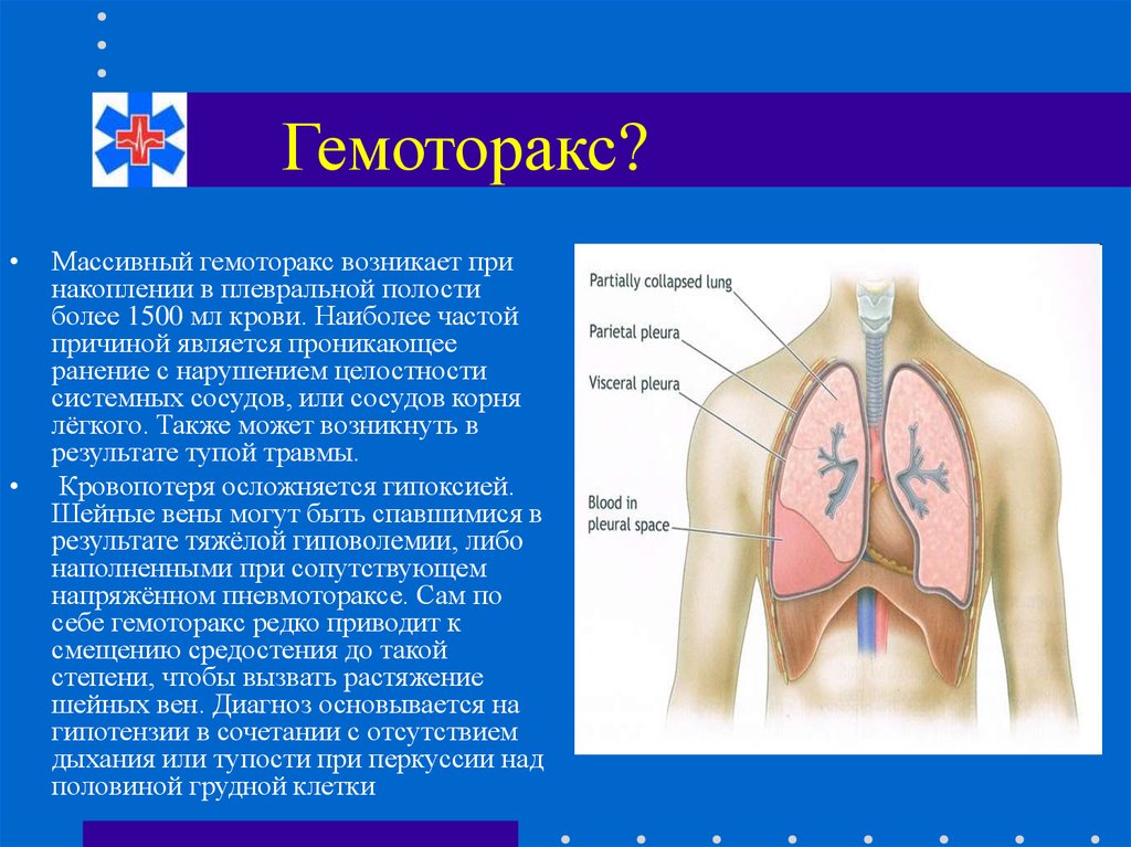 Презентация пневмоторакс и гемоторакс