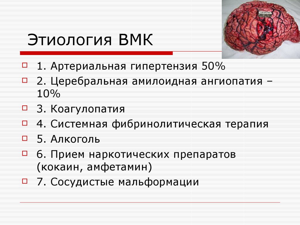 Геморрагический инсульт презентация