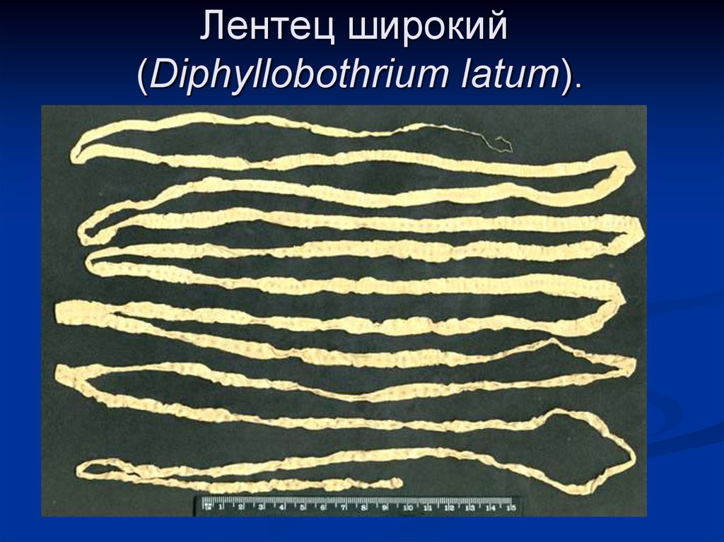 Ленточный червь длина. Ленточный червь лентец. Ленточный червь широкий лентец. Широкий лентец (Diphyllobothrium latum). Дифиллоботриоз (возбудитель — лентец широкий)..