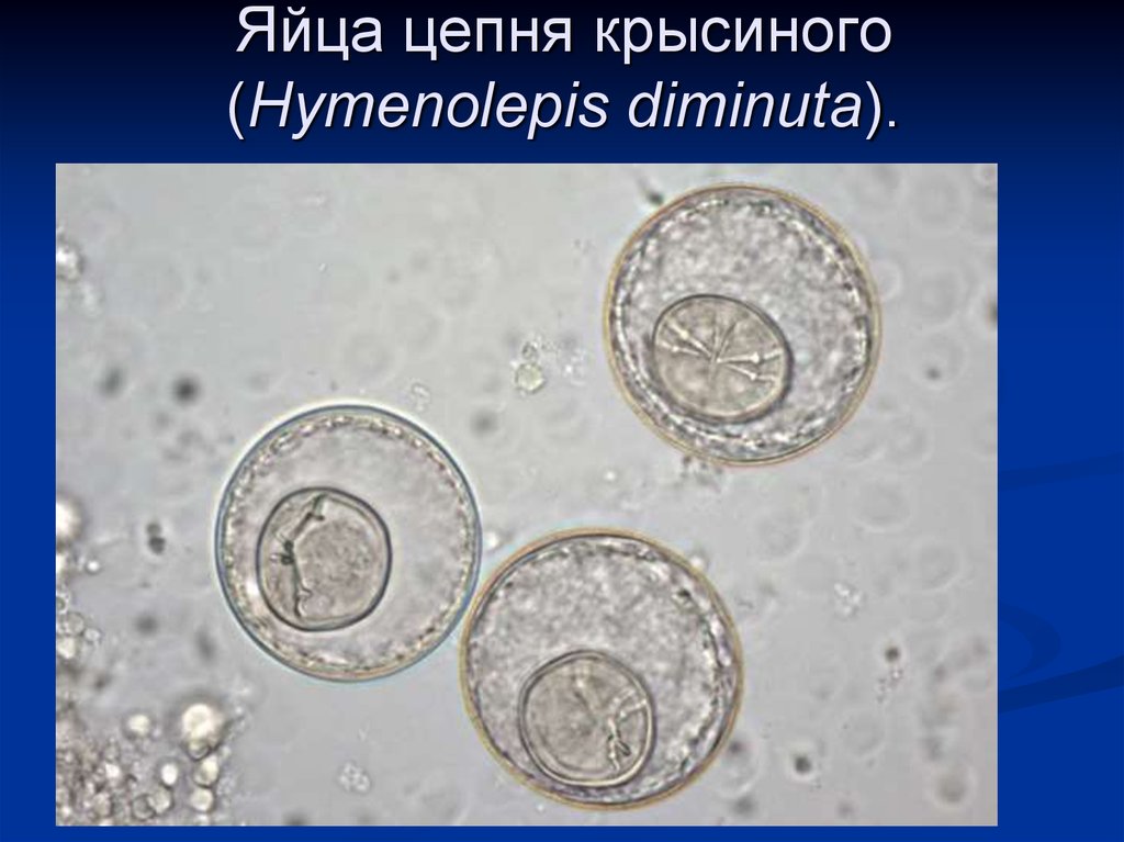 Яйца цепня. Hymenolepis diminuta яйца. Крысиный цепень онкосфера. Цепень крысиный Hymenolepis. Яйцо карликового цепня под микроскопом.