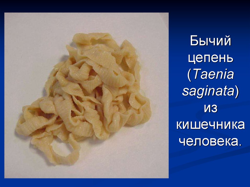 Бычий цепень. Бычий цепень из кишечника человека.