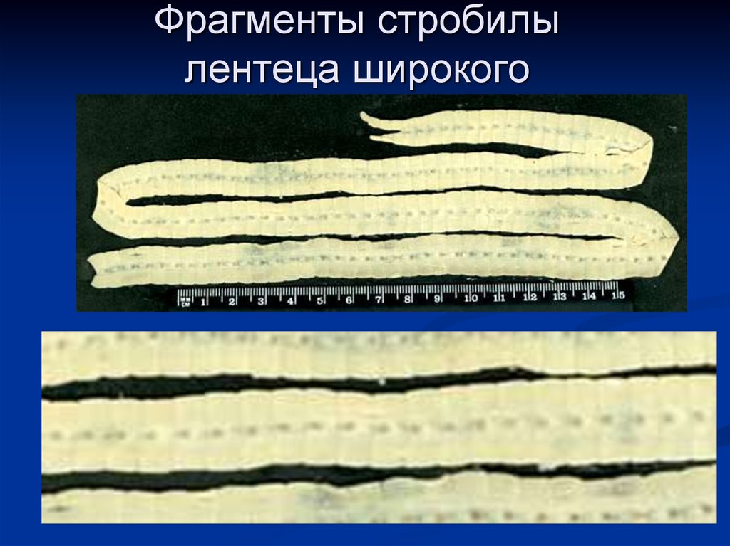 Широкого лентеца. Ленточный червь лентец. Фрагмент стробилы лентеца широкого. Ленточные черви широкий лентец. Широкий лентец стробила.