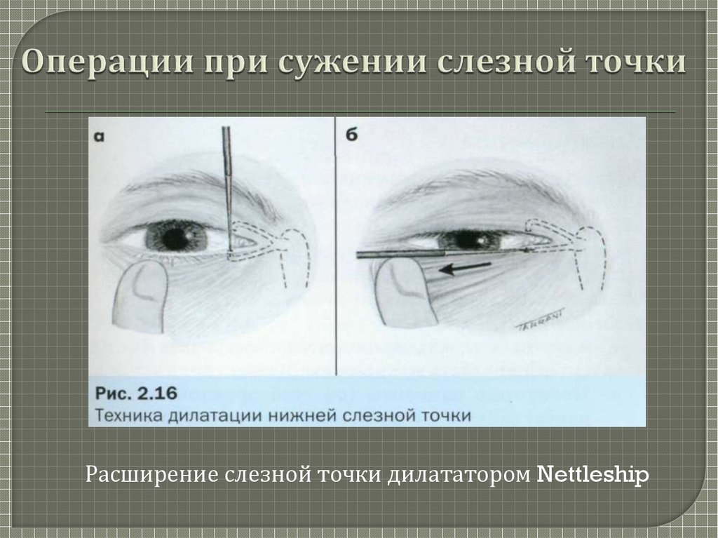 Заболевания век конъюнктивы и слезных органов презентация