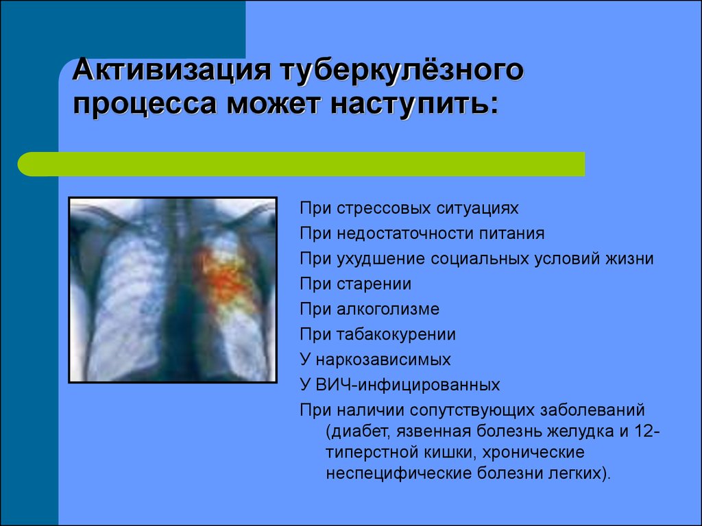 Туберкулез слайд. Туберкулез презентация. Симптомы туберкулеза кратко. Презентация по теме туберкулез.