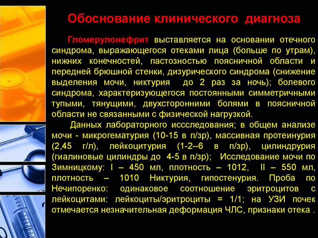 Хронический гломерулонефрит с нефротическим синдромом