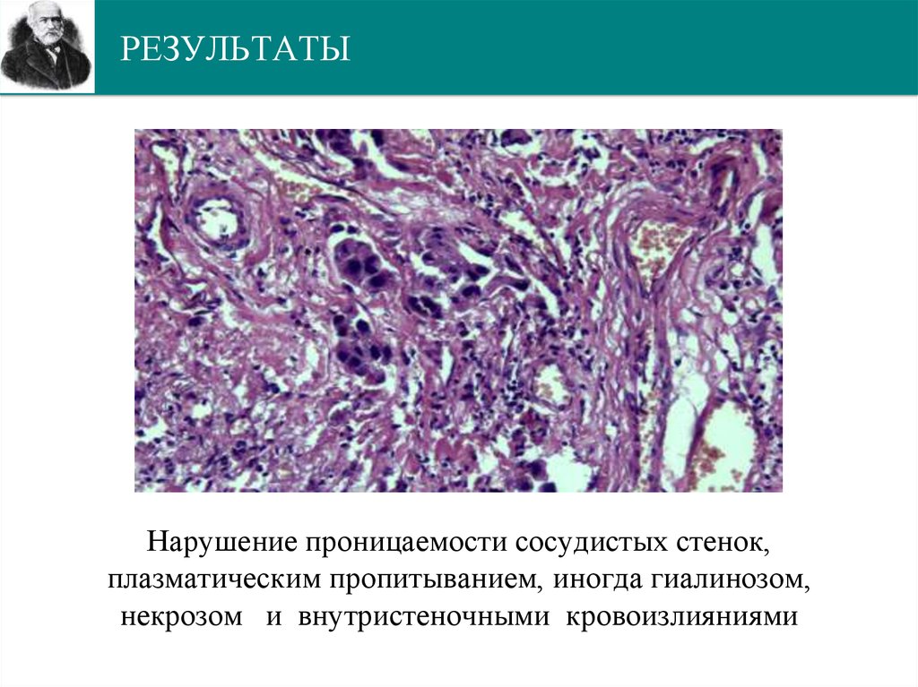 РЕЗУЛЬТАТЫ