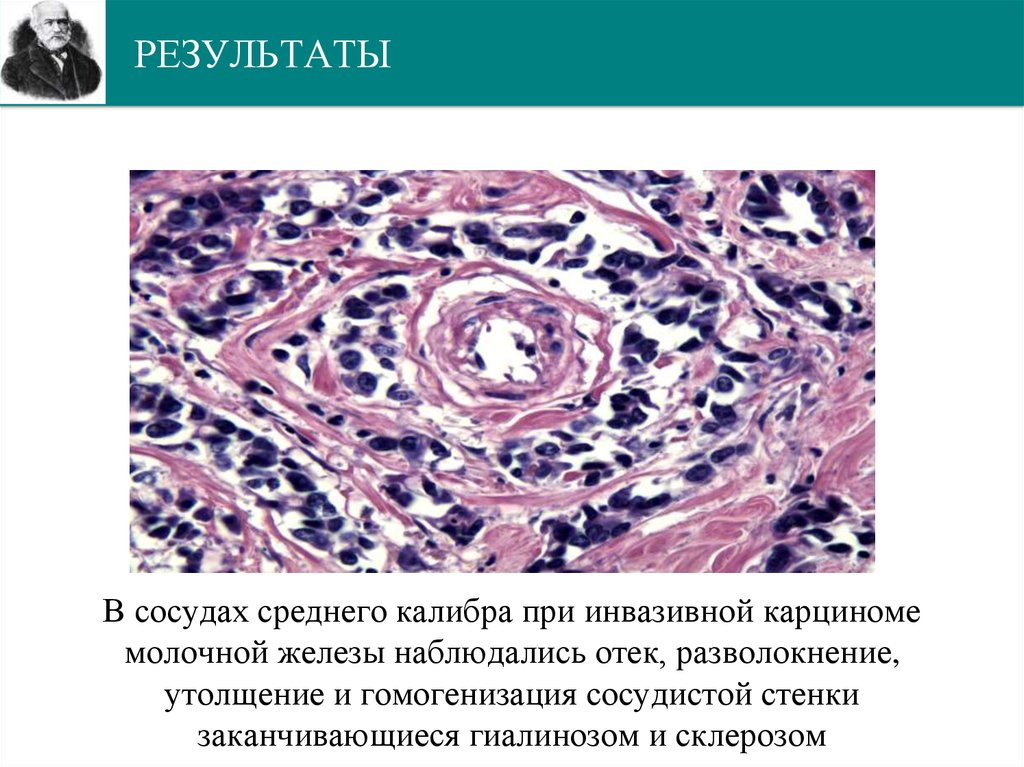 РЕЗУЛЬТАТЫ