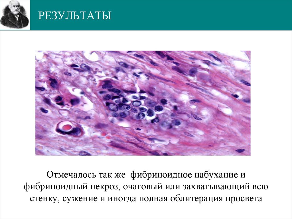 РЕЗУЛЬТАТЫ