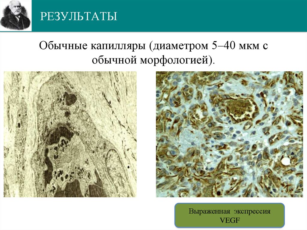 РЕЗУЛЬТАТЫ