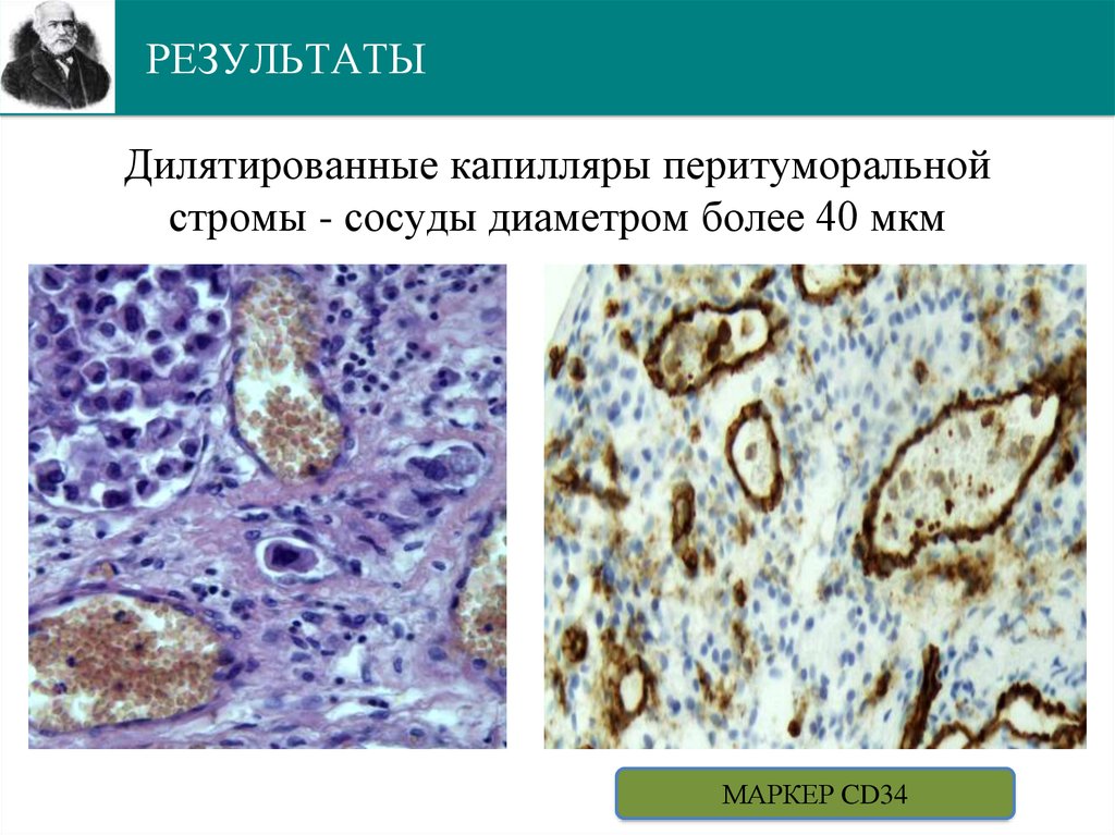 РЕЗУЛЬТАТЫ