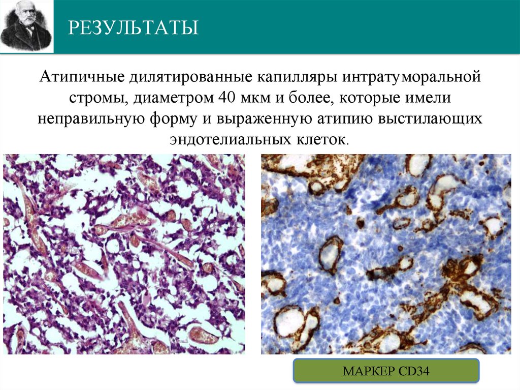 РЕЗУЛЬТАТЫ