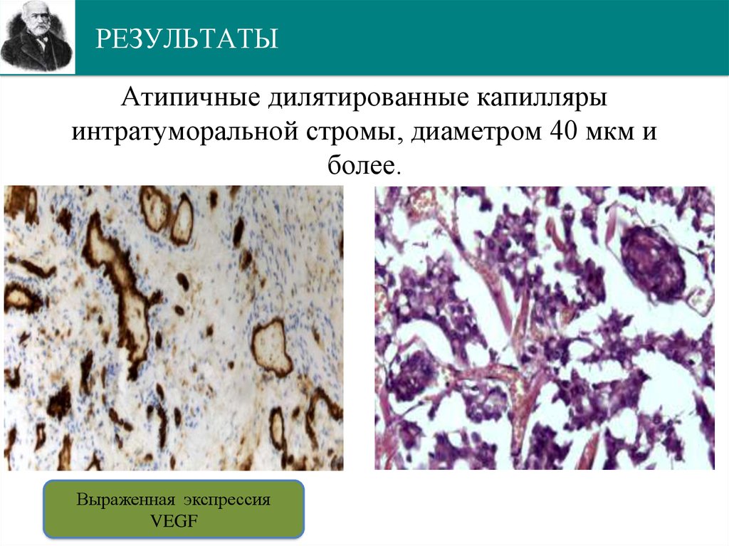 РЕЗУЛЬТАТЫ