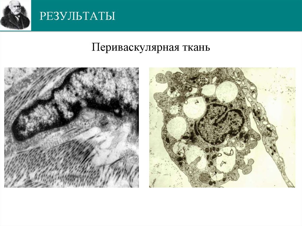 РЕЗУЛЬТАТЫ