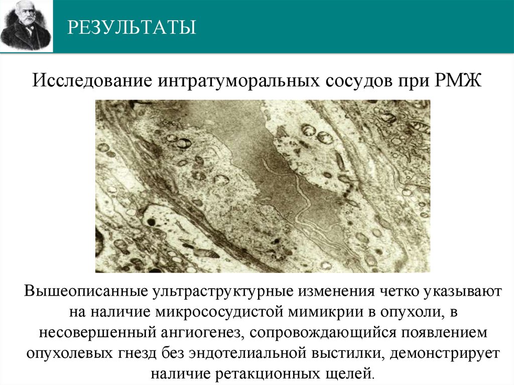 РЕЗУЛЬТАТЫ