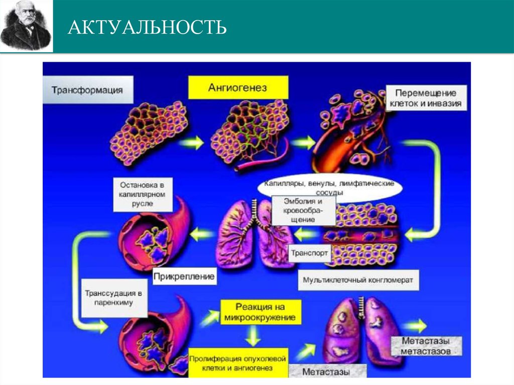 Перемещение клеток. Стимуляторы и ингибиторы ангиогенеза. Ангиогенез презентация. Роль эндотелиальных клеток в ангиогенезе. Роль ангиогенеза в процессе диссеминации опухолевых клеток.