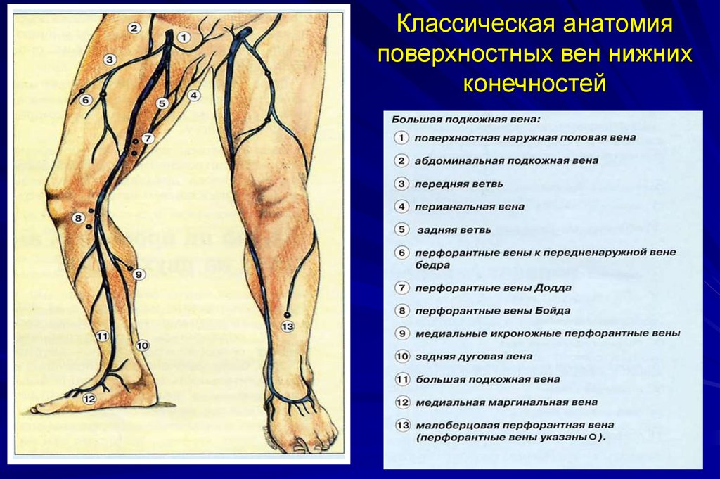 Варикоз корнилова схема