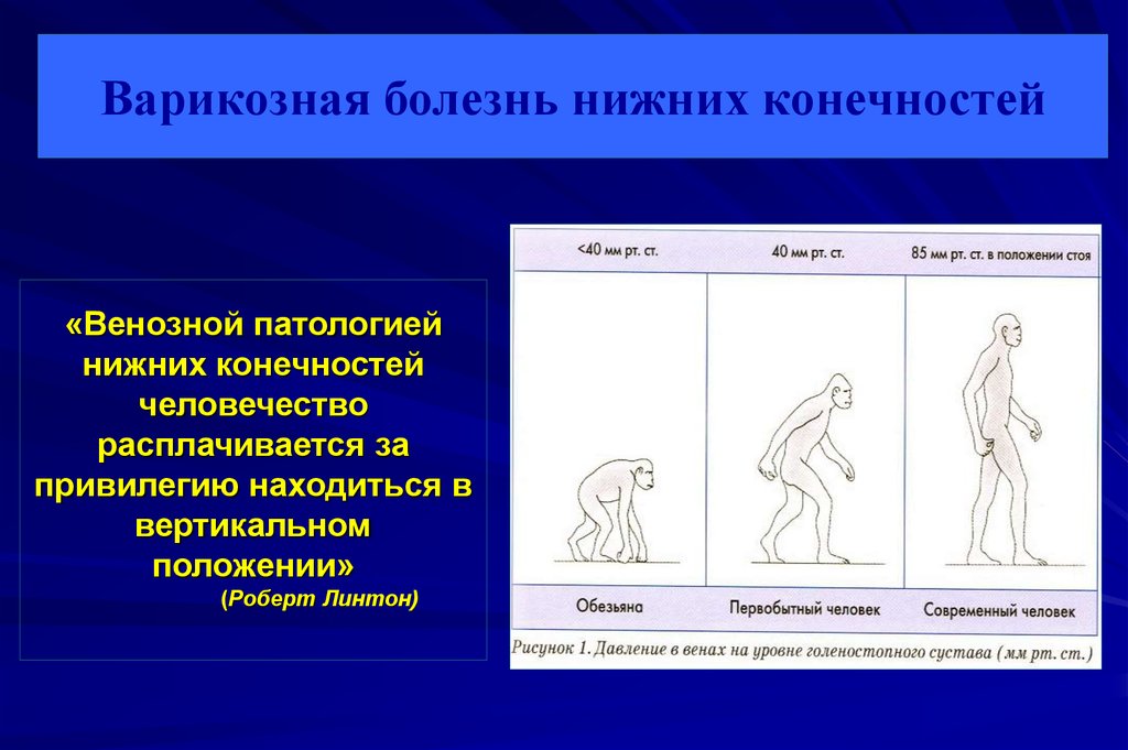 Варикозная болезнь вен нижних конечностей код мкб