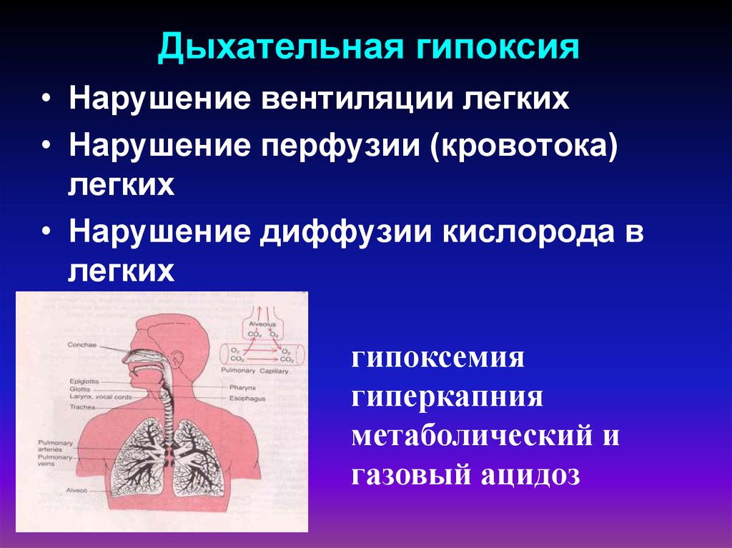 7 гипоксия. Дыхательная гипоксия проявления. Дыхательная (респираторная) гипоксия. Респираторная гипоксия проявления. Дыхательная гипоксия показатели.