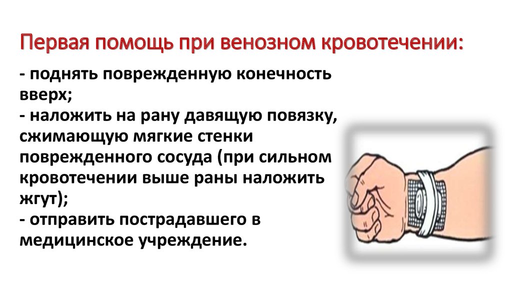 Давящая повязка при кровотечении время. Алгоритм оказания ПМП при венозном кровотечении. Алгоритм оказания 1 помощи при венозном кровотечении. Алгоритм оказания первой помощи при наружном венозном кровотечении.. Составьте алгоритм оказания первой помощи при венозном кровотечении.