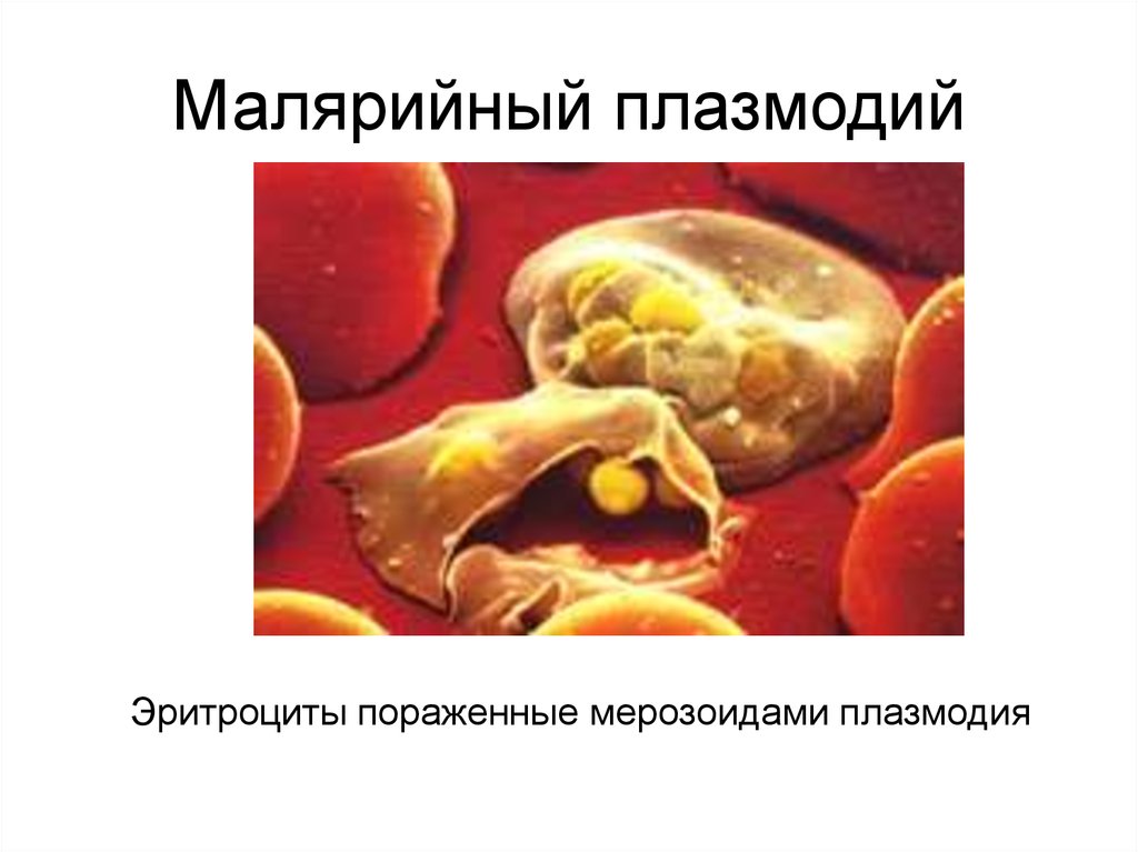 Малярийный плазмодий клетка. Эритроциты пораженные малярийным плазмодием. Малярийный плазмодий в эритроцитах. Малярийный плазмодий строение. Строение плазмодия малярии.